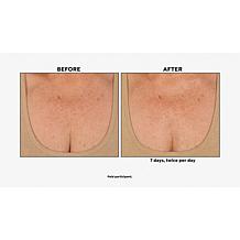 Nakery Beauty Firm + Wrinkle-Reducing Neck + Dec Serum