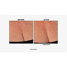 Nakery Beauty Firm + Wrinkle-Reducing Neck + Dec Serum