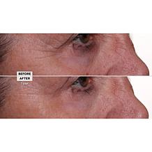 Nakery Beauty Lift-TOX 360 Firming Eye Lift Treatment Cream Auto-Ship®