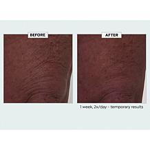 Nakery Beauty Lift-TOX Body Treatment Auto-Ship®