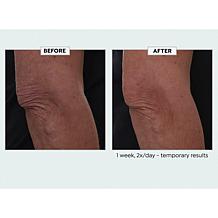 Nakery Beauty Lift-TOX Body Treatment