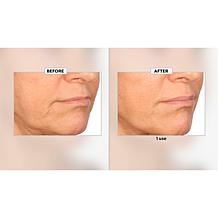 Nakery Beauty Peptide-Surge Intense Collagen Concentrate Auto-Ship®