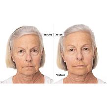 Nakery Beauty SkinInfusion Anti-Aging Serum and Oil Concentrate
