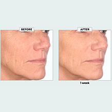 Nakery Beauty SkinRecovery Make it Vanish Power Cream w/Erase Complex