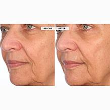 Nakery Beauty SkinRecovery The Age Edit Serum + Night Shift Concent...