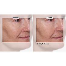 Nakery Beauty SkinRepair Retinol Deep Wrinkle Serum Auto-Ship®