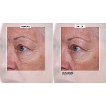 Nakery Beauty SkinRepair Retinol Wrinkle Serum