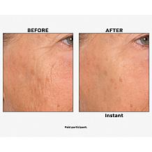 Nakery Beauty Skip the Line Instant Wrinkle Eraser Auto-Ship®