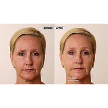 Nakery Beauty Skip the Line Instant Wrinkle Eraser