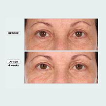 NassifMD 4-Piece Clean + Prep + Treat + Hydrate Skin Reset System