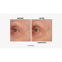 NassifMD® Age Defying Eye Renewal Serum with Dual Action Peptides AS