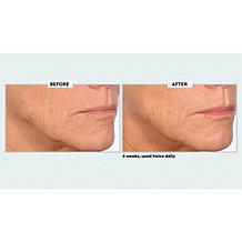 NassifMD Collagen Peptide Serum and Skincare Detox Pads Set