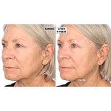 NassifMD Detox Pads and Hydro-Screen On-the-Go Set