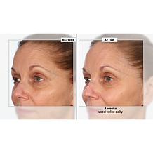 NassifMD Detox Pads & Vitamin C Brightening Serum 2-pc Set Auto-Ship®
