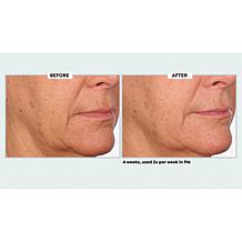NassifMD Even & Correct Retexturizing Pads Home & Go Kit