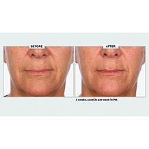 NassifMD Even & Correct Retexturizing Pads Home & Go Kit