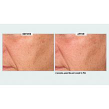 NassifMD Even & Correct Retexturizing Pads Home & Go Kit Auto-Ship®