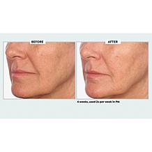 NassifMD Even, Correct & Renew Retexturizing Pads