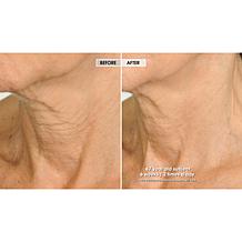 NassifMD Eye and Neck Targeted Peptide Try-Me 2-piece Set