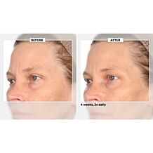 NassifMD Home and Go Niacinamide Biopeptide Serums