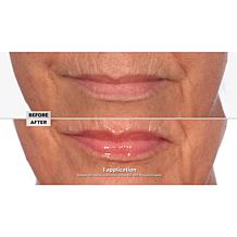 NassifMD® Hydro-Screen for Lips 2-Piece Set - Vanilla