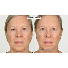 NassifMD® Hydro-Screen Hydrating Serum - Deluxe Size