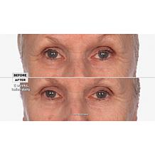 NassifMD® Hydro-Screen Hydrating Serum - Deluxe Size