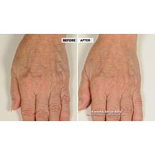 NassifMD Hydro-Screen Hydrating Serum Home & Go 2-piece Set