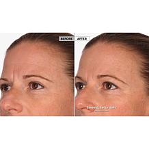 NassifMD Hydro-Screen Hydrating Serum Home & Go 2-piece Set