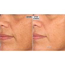 NassifMD Hydro-Screen Hydrating Serum Home & Go 2-piece Set Auto-Ship®