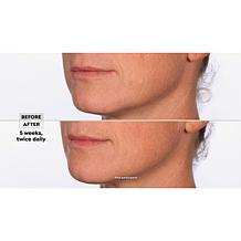 NassifMD Hydro-Screen Hydrating Serum Home & Go 2-piece Set Auto-Ship®