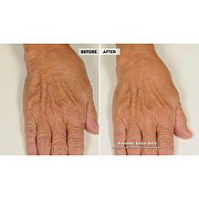 NassifMD Hydro-Screen Hydrating Serum Home & Go 2-piece Set