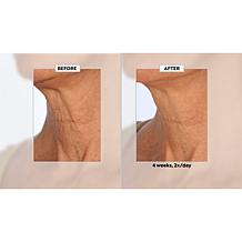 NassifMD Neck & Decollete Upfinity Peptide Complex Serum