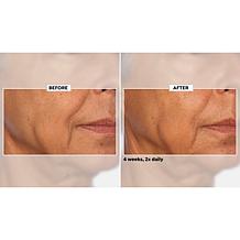 NassifMD Niacinamide Biopeptide Smoothing Serum