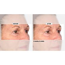 NassifMD Niacinamide Smoothing Serum Auto-Ship®