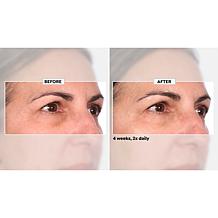 NassifMD Niacinamide Smoothing Serum Auto-Ship®