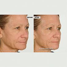 NassifMD Night Therapy Serum