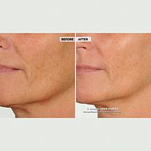 NassifMD Night Therapy Serum