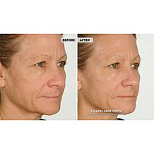 NassifMD Night Therapy Serum with Vitamin C & Retinol