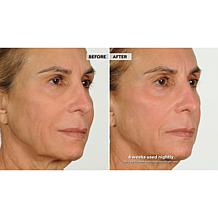 NassifMD Night Therapy Serum with Vitamin C & Retinol