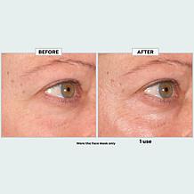 NassifMD Peptide-Infused Hydrating Face Mask and Eye Set