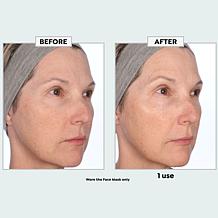 NassifMD Peptide-Infused Hydrating Face Mask and Eye Set
