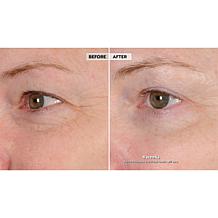 NassifMD® Peri-Orbital Eye Complex
