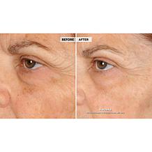 NassifMD® Peri-Orbital Eye Complex