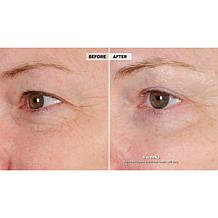 NassifMD® Peri Orbital Eye Complex Duo