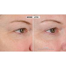 NassifMD® Peri Orbital Eye Complex Duo