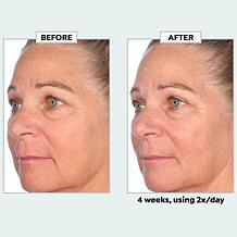 NassifMD Restore & Firm Face Oil with CoQ10