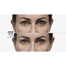 Perfect Cosmetic Perfect Eyes and Day Cream Set