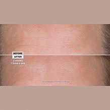 Perlier 4.6 oz Royal Elixir Youth Creator Serum - Auto-Ship®