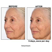 Perlier Black Rice 5-Day Brightening Serum